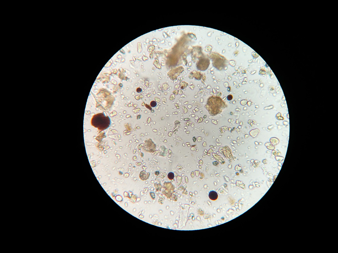 soil-microbes-1802199_1920