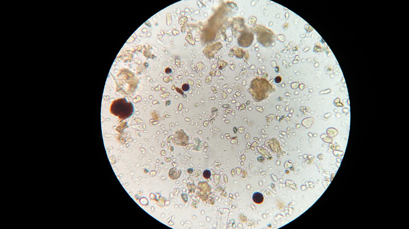 soil-microbes-1802199_1920
